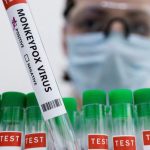 Cordoba: Confirmaron el primer caso de viruela símica